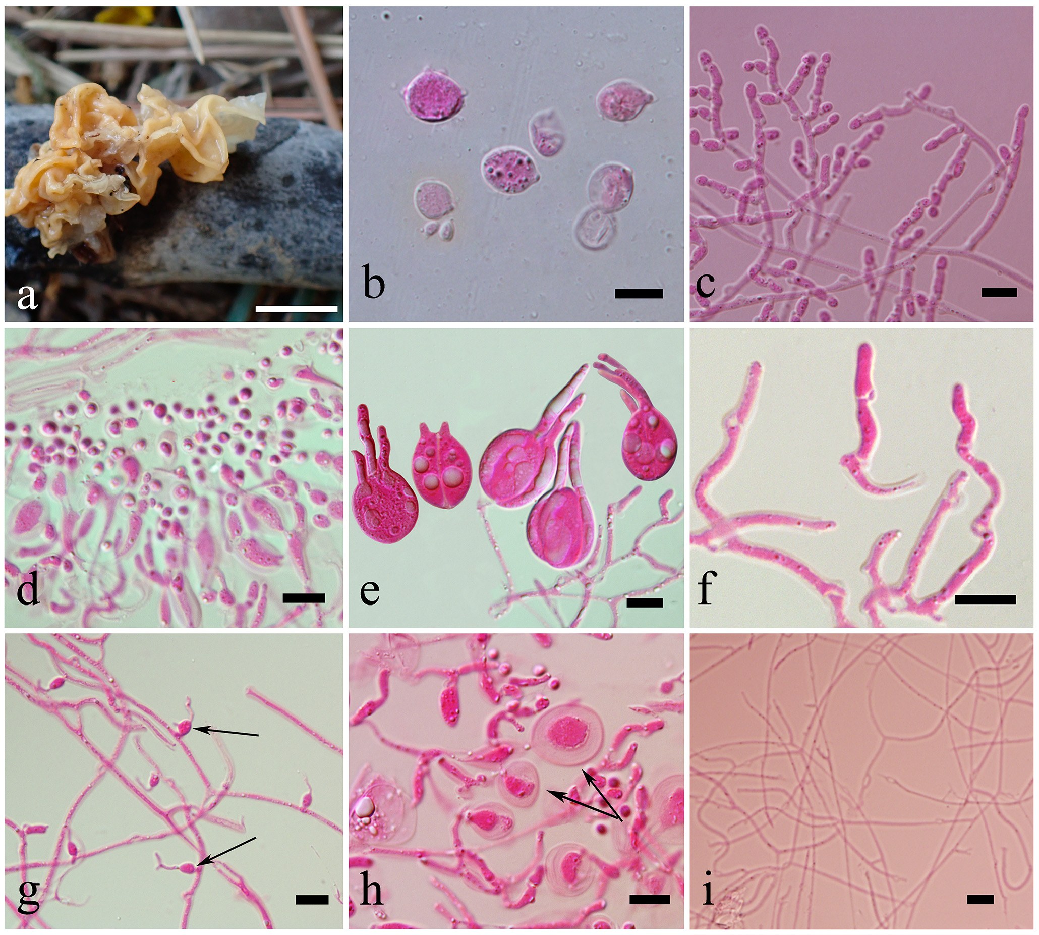 Figure 74